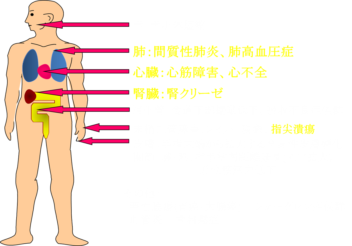 は マスト 細胞 と